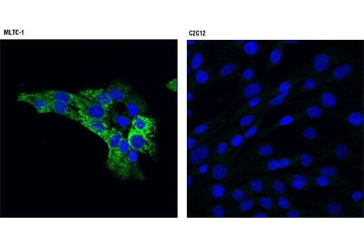 Immunofluorescence Image 1: StAR (D10H12) Rabbit Monoclonal Antibody