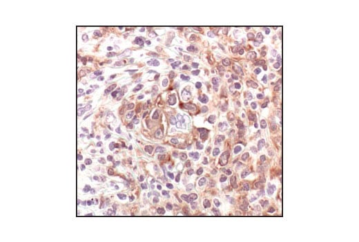 Immunohistochemistry Image 1: TRAF1 (1F3) Rat Monoclonal Antibody