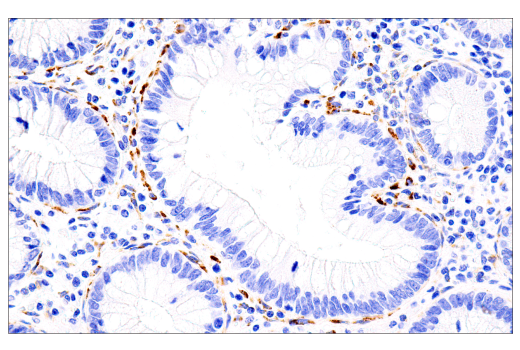 Immunohistochemistry Image 2: COL5A1 (E6U9W) Rabbit Monoclonal Antibody