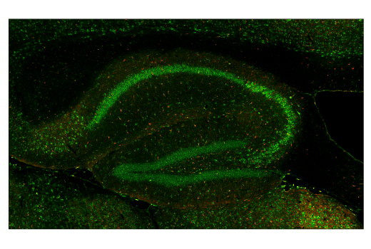 Immunofluorescence Image 1: Cathepsin D (E7Z4L) XP<sup>®</sup> Rabbit mAb (BSA and Azide Free)