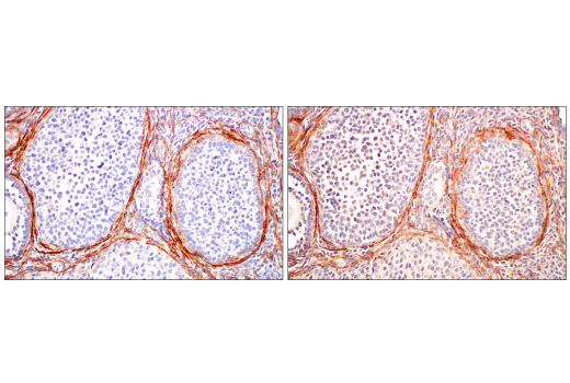 Immunohistochemistry Image 5: TMEM119 (E3W5L) Rabbit Monoclonal Antibody