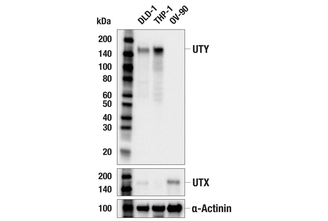 Western Blotting Image 2: UTY (E3C2J) Rabbit Monoclonal Antibody