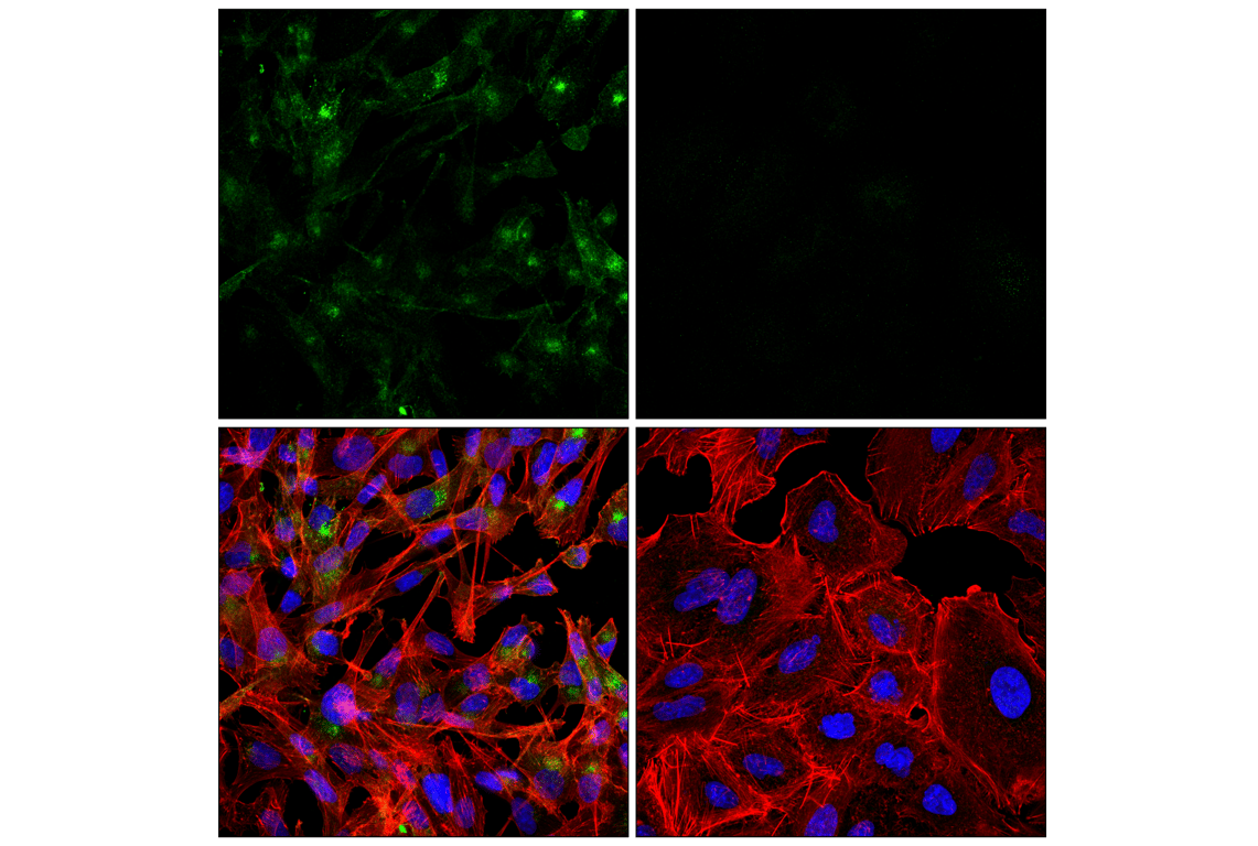 Immunofluorescence Image 1: DDR2 (E6V2N) Rabbit Monoclonal Antibody (BSA and Azide Free)