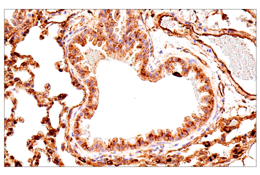 Immunohistochemistry Image 5: LAMP1 (E6N3R) Rabbit Monoclonal Antibody