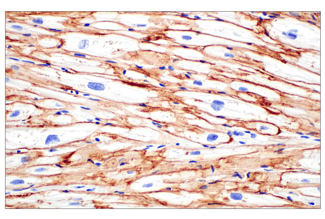 Immunohistochemistry Image 3: Dystrophin (E4F3S) Rabbit Monoclonal Antibody