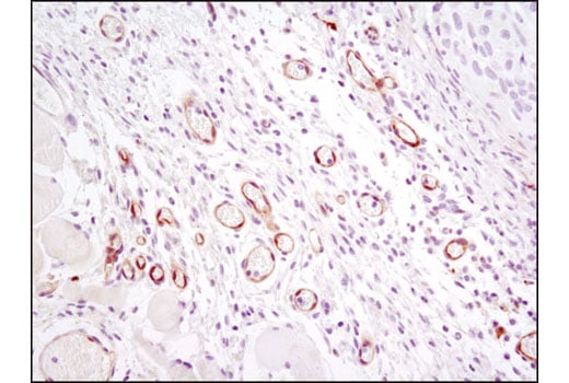 Immunohistochemistry Image 3: VEGF Receptor 2 (D5B1) Rabbit mAb