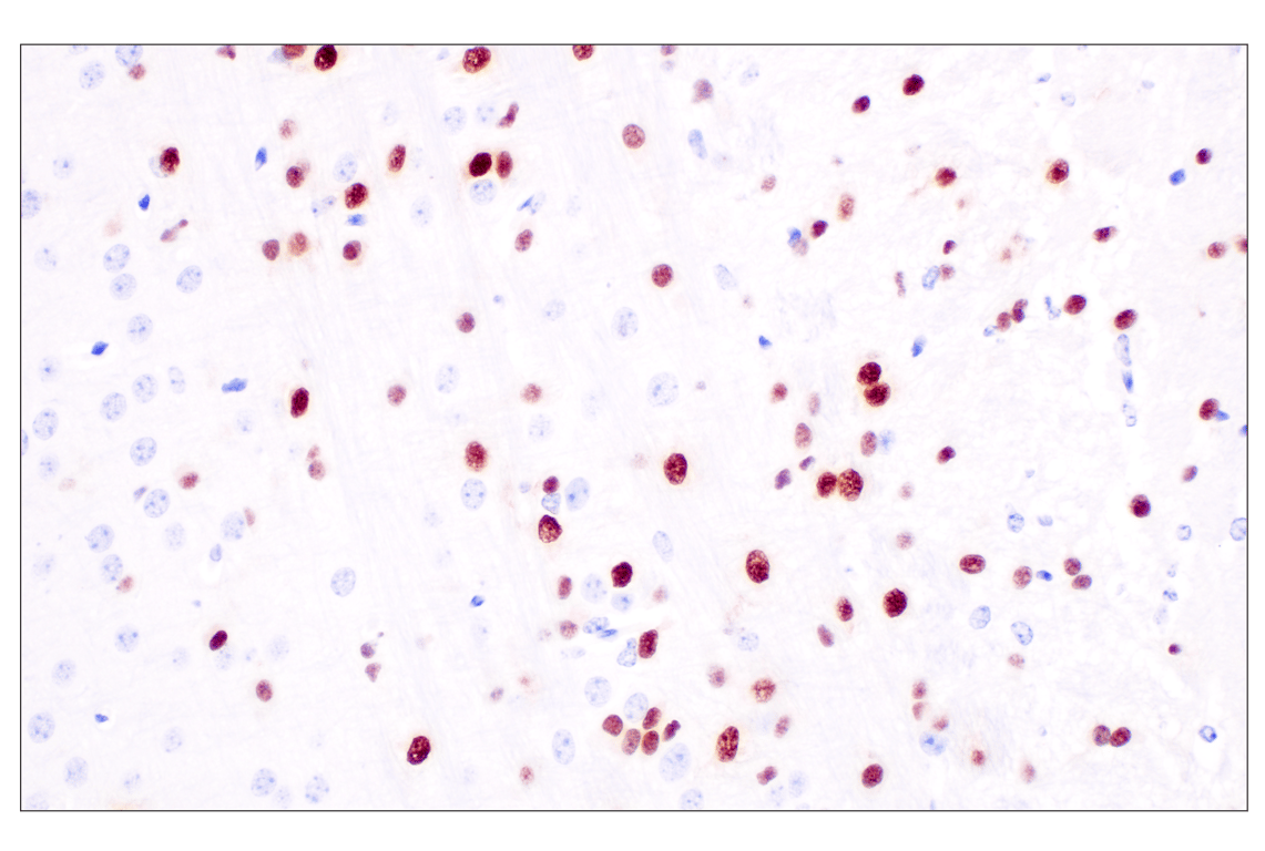 Immunohistochemistry Image 7: Sox10 (E2V9N) Rabbit Monoclonal Antibody (BSA and Azide Free)