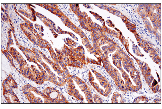 Immunohistochemistry Image 5: CD151 (E4I9J) Rabbit Monoclonal Antibody