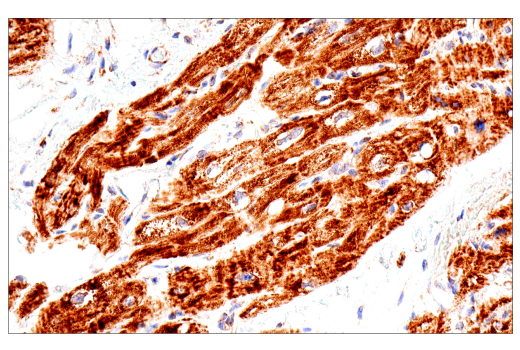 Immunohistochemistry Image 6: SDHB (E3H9Z) Rabbit Monoclonal Antibody