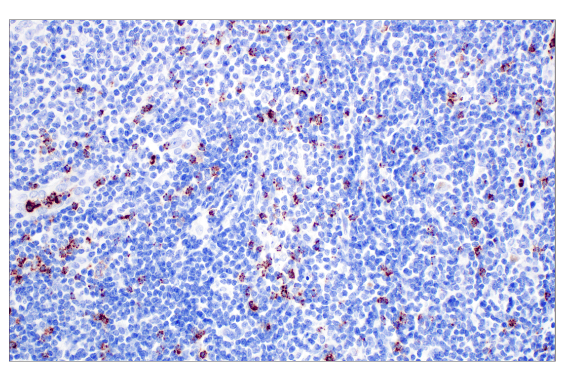 Immunohistochemistry Image 1: NKG7 (F4V5I) Rabbit Monoclonal Antibody