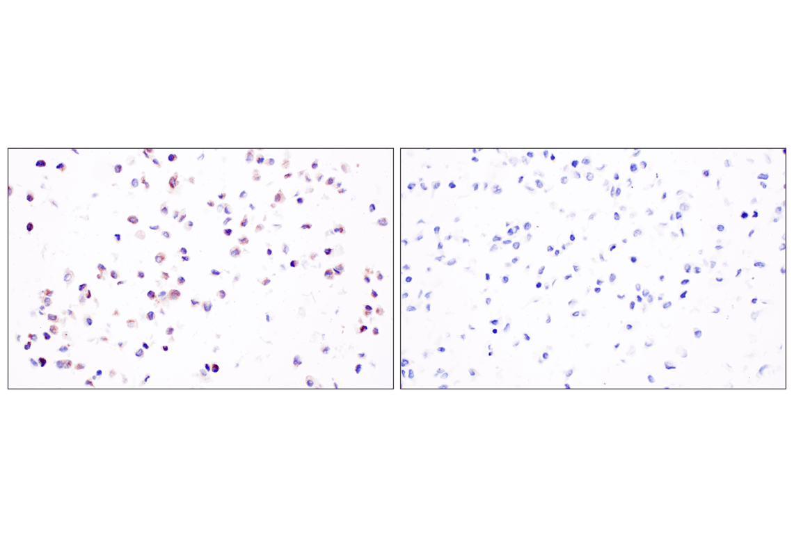 Immunohistochemistry Image 6: beta2-microglobulin (F4S6H) Rabbit Monoclonal Antibody