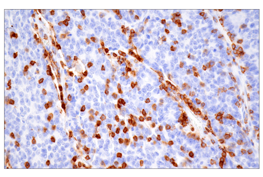 Immunohistochemistry Image 1: CD43 (MT1) Mouse Monoclonal Antibody