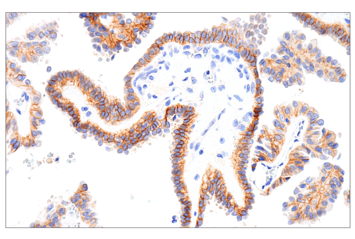 Immunohistochemistry Image 2: IGF-I Receptor beta (D4O6W) Rabbit Monoclonal Antibody