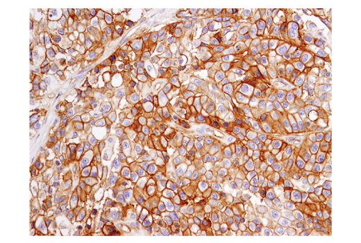 Immunohistochemistry Image 1: PVR/CD155 (D8A5G) Rabbit Monoclonal Antibody (BSA and Azide Free)