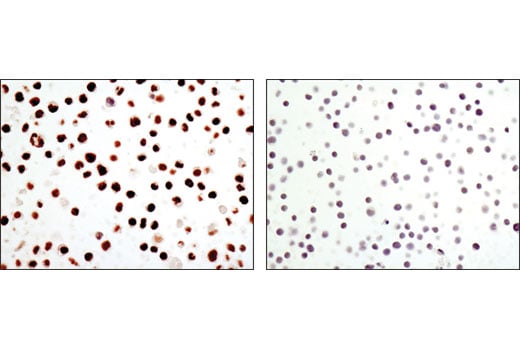 Immunohistochemistry Image 2: C/EBPα (D56F10) XP<sup>®</sup> Rabbit mAb