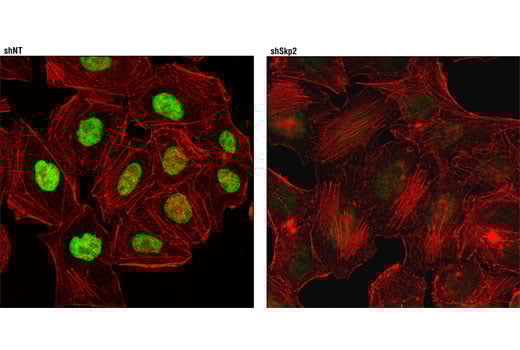 Immunofluorescence Image 1: Skp2 (D3G5) Rabbit Monoclonal Antibody (BSA and Azide Free)