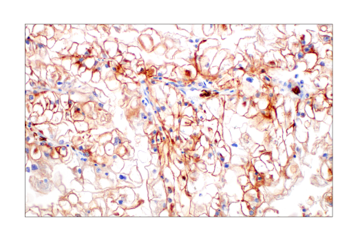 Immunohistochemistry Image 5: Glut1 (E4S6I) Rabbit Monoclonal Antibody