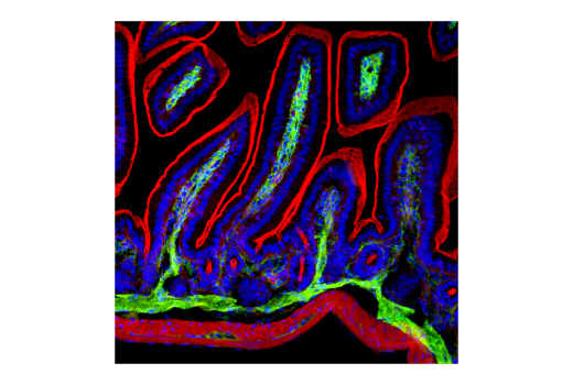 Immunofluorescence Image 1: VCAM-1 (D8U5V) Rabbit Monoclonal Antibody