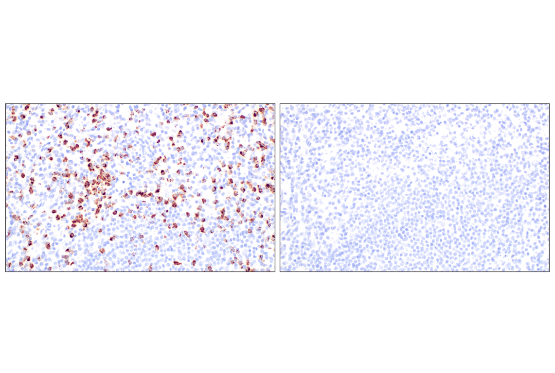 Immunohistochemistry Image 10: NKG7 (F4V5I) Rabbit Monoclonal Antibody
