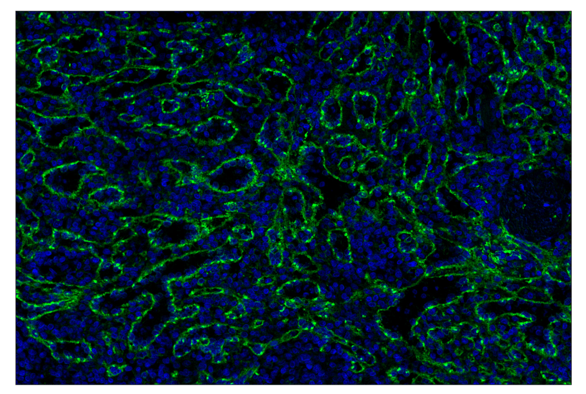 Immunohistochemistry Image 2: CD206/MRC1 (E2L9N) Rabbit Monoclonal Antibody (Alexa Fluor<sup>®</sup> 488 Conjugate)