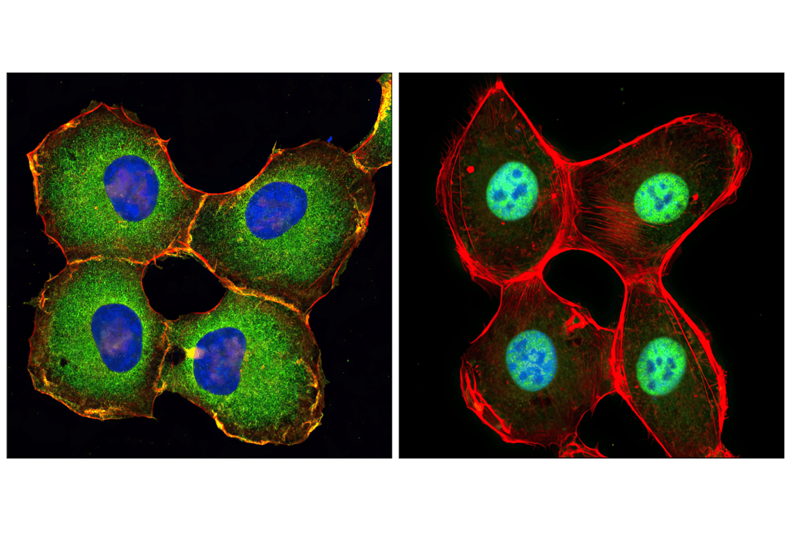 Immunofluorescence Image 1: NF-kappaB p65 (D14E12) Rabbit Monoclonal Antibody