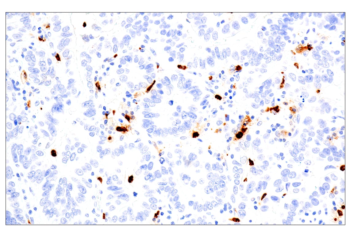 Immunohistochemistry Image 3: Eosinophil cationic protein (E6U5M) Rabbit Monoclonal Antibody (BSA and Azide Free)