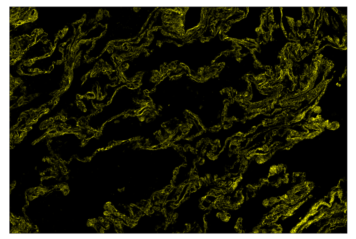 Immunohistochemistry Image 3: COL1A1 (E8F4L) & CO-0106-488 SignalStar<sup>™</sup> Oligo-Antibody Pair