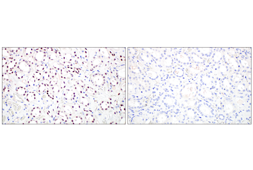 Immunohistochemistry Image 8: POU2F3 (E5N2D) Rabbit Monoclonal Antibody