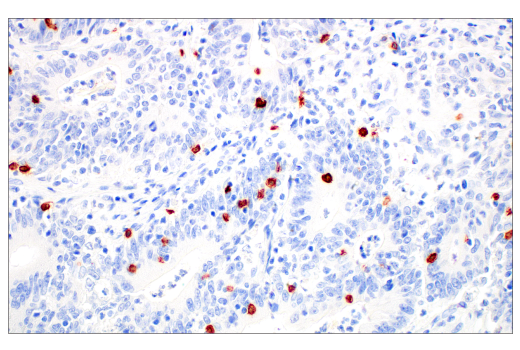 Immunohistochemistry Image 1: TRDC/TCR delta (E2E9T) Rabbit Monoclonal Antibody