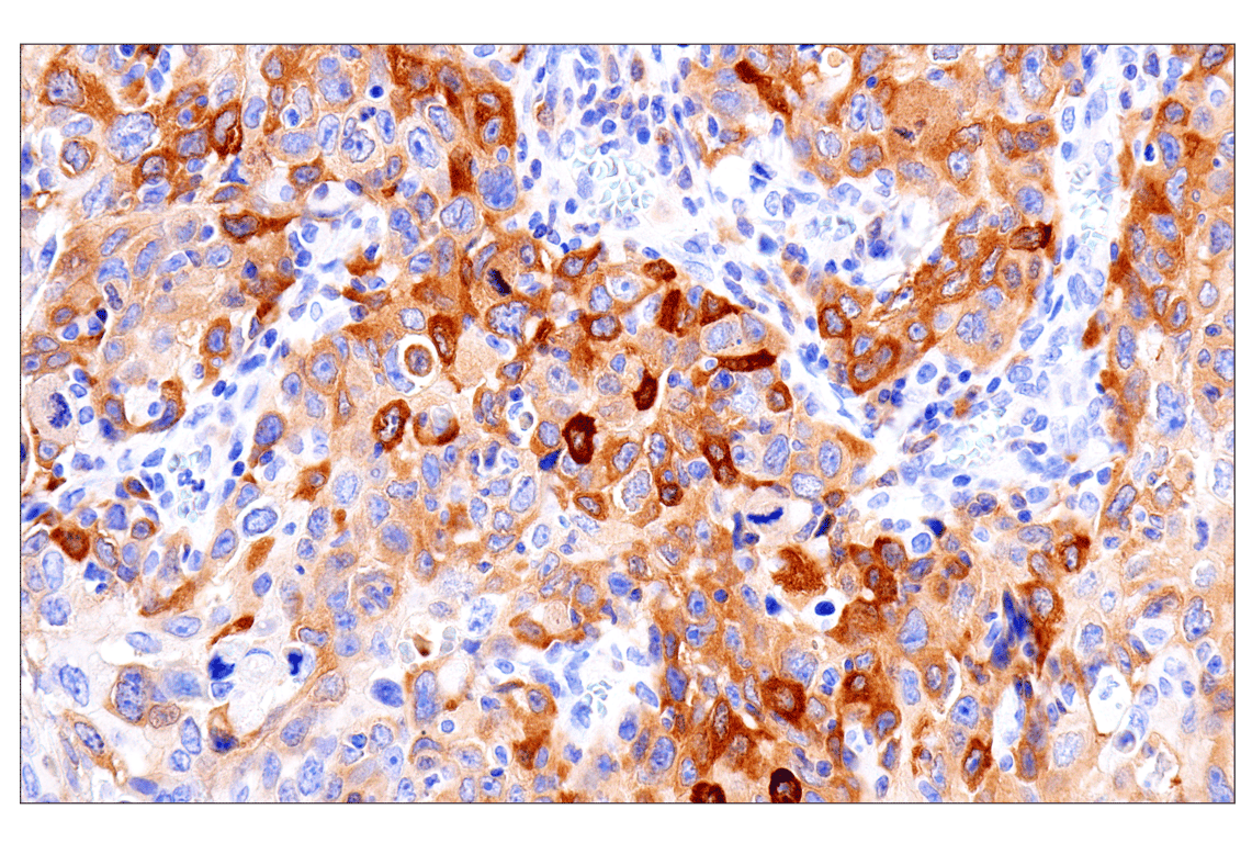 Immunohistochemistry Image 1: Asparagine Synthetase (E6C2C) Rabbit Monoclonal Antibody (BSA and Azide Free)