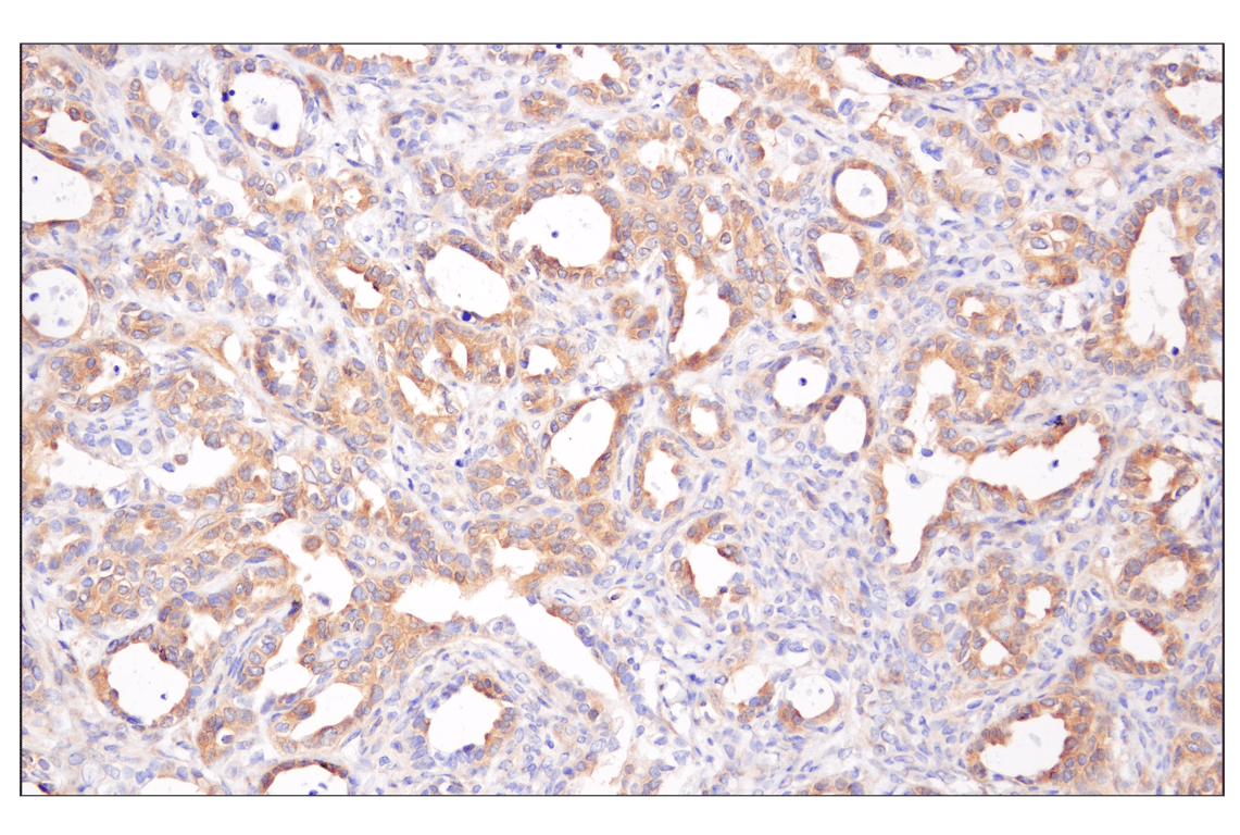 undefined Image 7: PhosphoPlus<sup>®</sup> AMPKα (Thr172) Antibody Duet