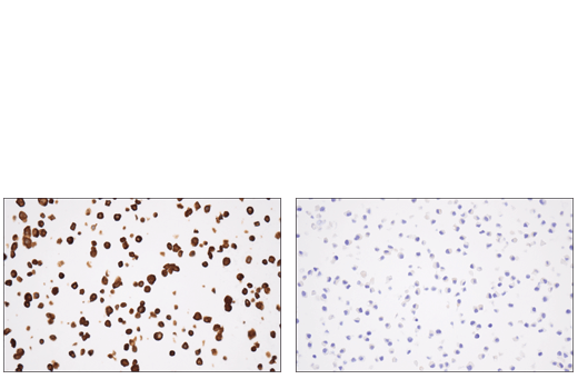 Tyrosine Hydroxylase (E2L6M) Rabbit mAb | Cell Signaling