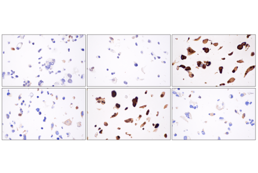 Immunohistochemistry Image 2: TAZ (E9J5A) Rabbit Monoclonal Antibody (BSA and Azide Free)