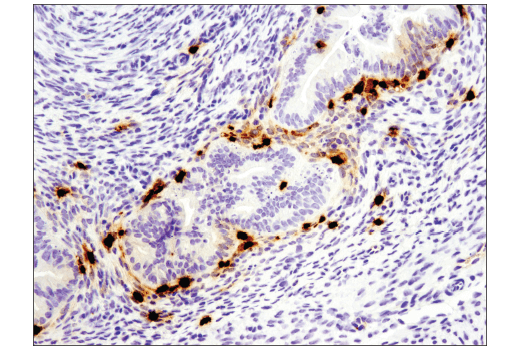 Immunohistochemistry Image 1: S100A9 (D3U8M) Rabbit Monoclonal Antibody (BSA and Azide Free)