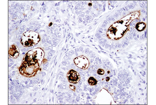 Immunohistochemistry Image 2: CD133 (D4W4N) Rabbit Monoclonal Antibody (BSA and Azide Free)