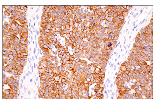 Immunohistochemistry Image 3: Pan-Keratin (5D3/LP34) Mouse Monoclonal Antibody