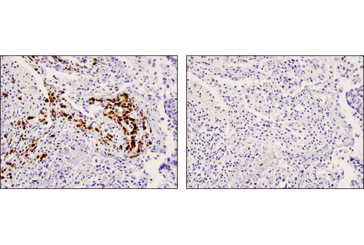 Immunohistochemistry Image 2: CD79A (D1X5C) Rabbit Monoclonal Antibody (BSA and Azide Free)