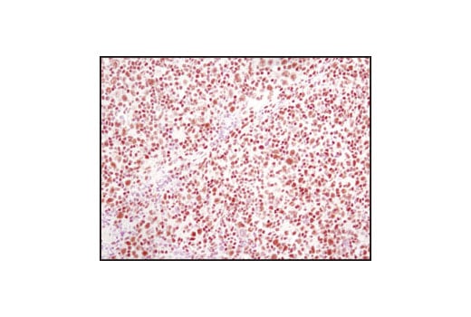 Immunohistochemistry Image 3: CTCF (D31H2) Rabbit Monoclonal Antibody (BSA and Azide Free)