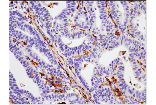 Immunohistochemistry Image 1: VISTA (D1L2G) Rabbit Monoclonal Antibody (BSA and Azide Free)