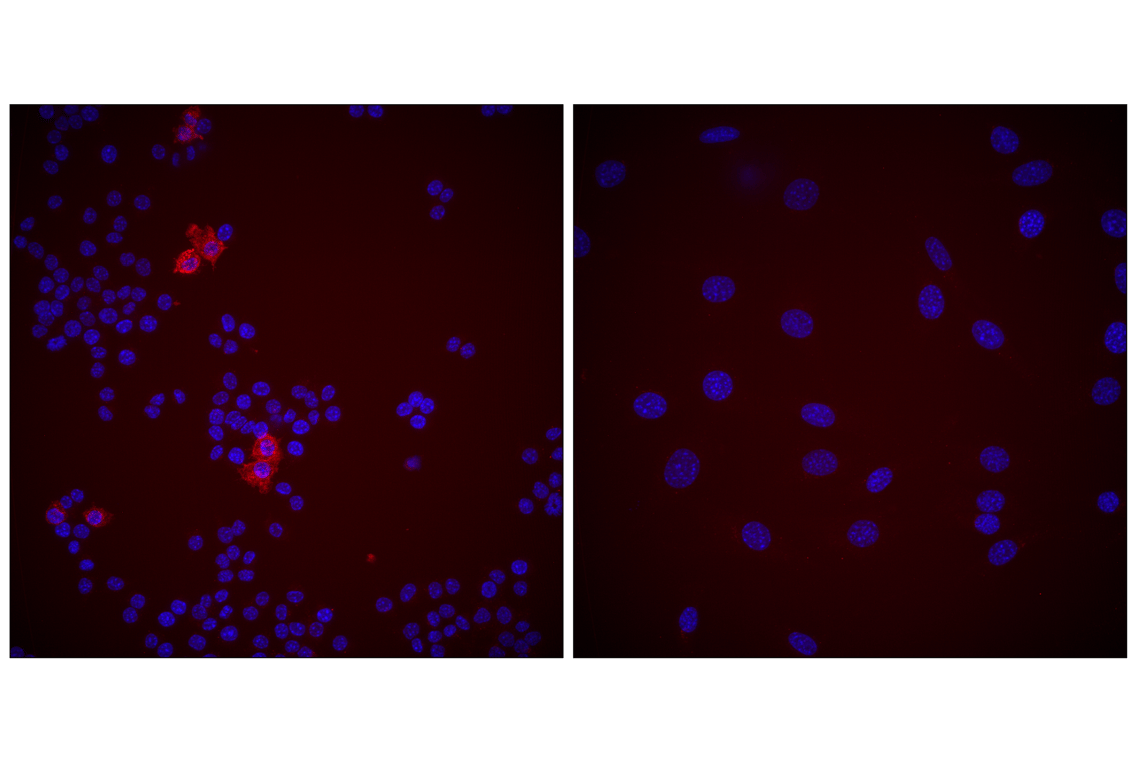 Immunofluorescence Image 1: CD11c (D1V9Y) Rabbit Monoclonal Antibody (Alexa Fluor<sup>®</sup> 555 Conjugate)