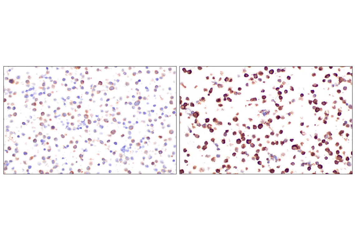 Immunohistochemistry Image 10: Fumarase (D9C5) Rabbit Monoclonal Antibody