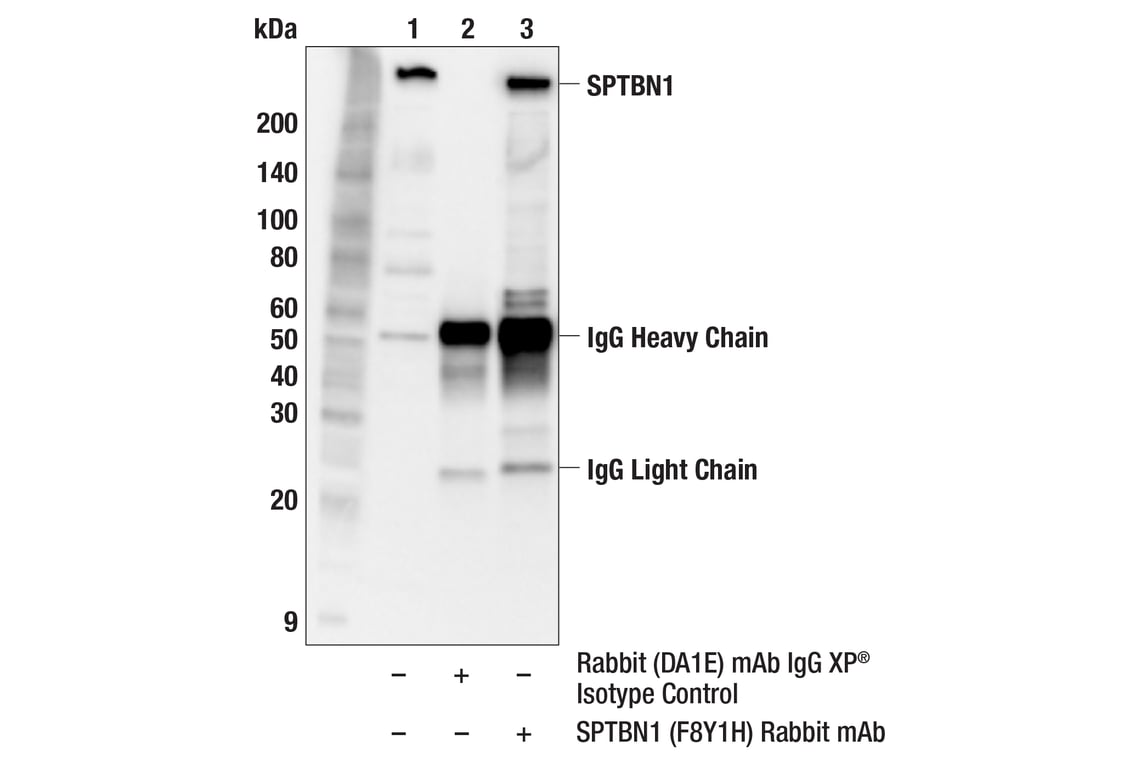 Immunoprecipitation Image 1: SPTBN1 (F8Y1H) Rabbit Monoclonal Antibody