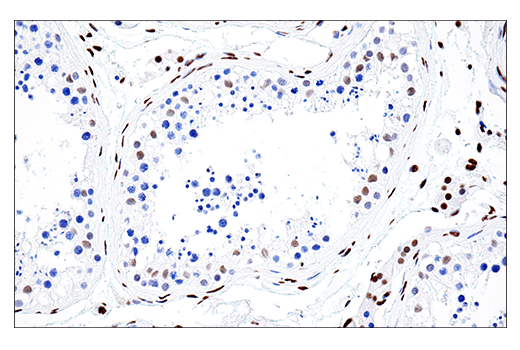 Immunohistochemistry Image 5: PML (E6S9L) Rabbit Monoclonal Antibody