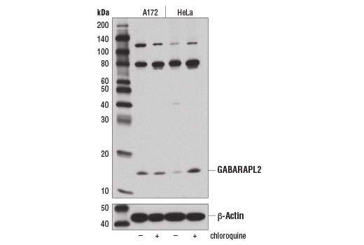 undefined Image 18: Autophagy Atg8 Family Antibody Sampler Kit