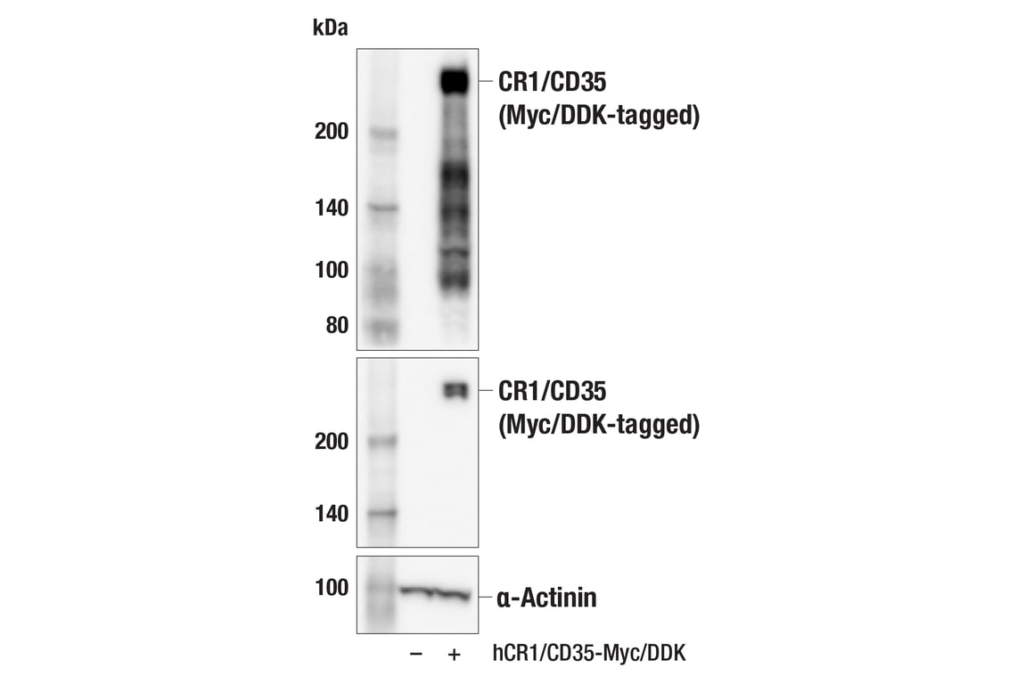 Western Blotting Image 2: CR1/CD35 (E8B1Z) Rabbit Monoclonal Antibody