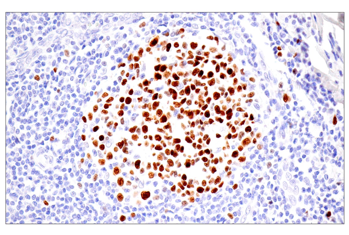 Immunohistochemistry Image 9: UHRF1 (E5W8W) Rabbit Monoclonal Antibody