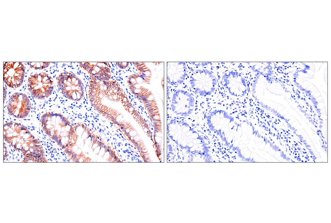 Immunohistochemistry Image 7: Cadherin-17 (E5J8Z) Rabbit Monoclonal Antibody