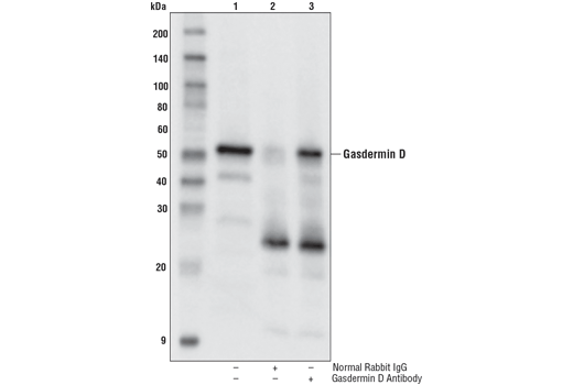 Immunoprecipitation Image 1: Gasdermin D Antibody