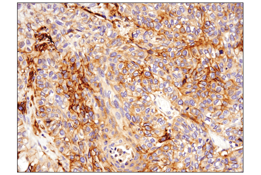 Immunohistochemistry Image 4: Podoplanin (LpMab-12) Mouse Monoclonal Antibody