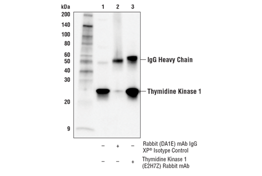 Immunoprecipitation Image 1: Thymidine Kinase 1 (E2H7Z) Rabbit Monoclonal Antibody